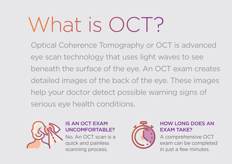 OCT retinal cross-section scan showing individual tissue layers