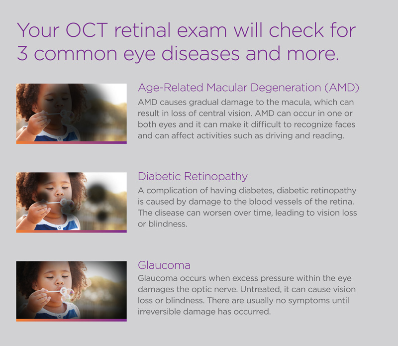 OCT retinal thickness analysis map used for glaucoma and AMD monitoring